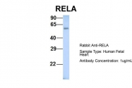 ARP30371_P050 - RELA / NF-kB p65