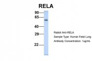 ARP30371_P050 - RELA / NF-kB p65