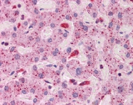 ARP30551_P050 - CD282 / TLR2