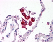 ARP30551_P050 - CD282 / TLR2