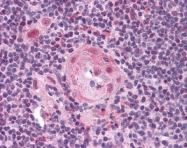 ARP30551_P050 - CD282 / TLR2