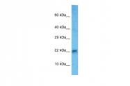 ARP30571_P050 - HAND2 / DHAND