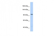 ARP30652_P050 - Insulin-degrading enzyme