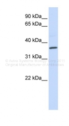 ARP30788_P050 - CD195 / CCR5