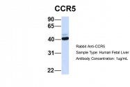 ARP30788_P050 - CD195 / CCR5