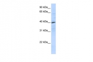 ARP30799_P050 - CD184 / CXCR4