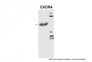 ARP30799_P050 - CD184 / CXCR4