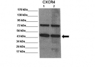 ARP30799_P050 - CD184 / CXCR4
