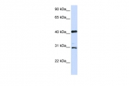 ARP30876_P050 - Aurora kinase A