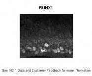 ARP30954_P050 - RUNX1