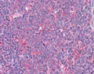ARP31048_P050 - STAT6