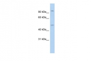 ARP31090_P050 - Glucocorticoid receptor