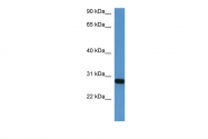 ARP31384_P050 - HOXB1 / HOX2I