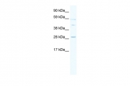 ARP31421_P050 - SPI1 / PU.1