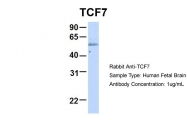 ARP31429_P050 - TCF7 / TCF1