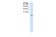 ARP31451_P050 - HDAC6