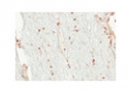ARP31464_P050 - OLIG2
