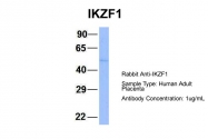 ARP31470_P050 - IKZF1 / IKAROS