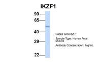 ARP31470_P050 - IKZF1 / IKAROS