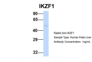 ARP31470_P050 - IKZF1 / IKAROS