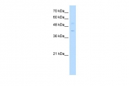 ARP31493_P050 - Krueppel-like factor 1 (KLF1)