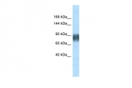 ARP31494_P050 - Advillin