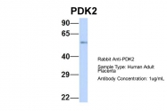 ARP31776_P050 - PDK1