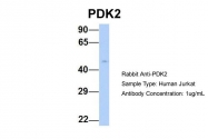 ARP31776_P050 - PDK1
