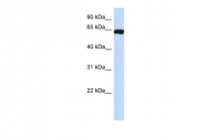 ARP31802_P050 - HIC2 / ZBTB30