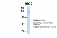 ARP31802_P050 - HIC2 / ZBTB30