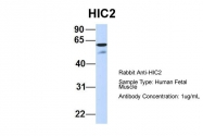 ARP31802_P050 - HIC2 / ZBTB30