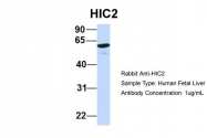 ARP31802_P050 - HIC2 / ZBTB30