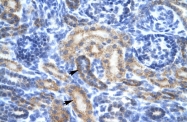 ARP31898_T100 - OR13C9