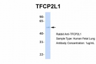 ARP31918_P050 - TFCP2L1