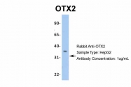 ARP32439_P050 - OTX2