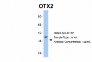 ARP32439_P050 - OTX2