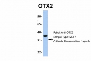 ARP32439_P050 - OTX2