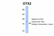 ARP32439_P050 - OTX2