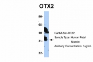 ARP32439_P050 - OTX2