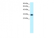 ARP31926_P050 - RAX / RX