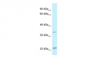 ARP31991_P050 - Insulin promoter factor 1