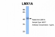ARP31999_T100 - LMX1A