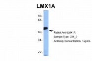 ARP31999_T100 - LMX1A
