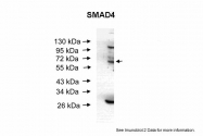 ARP32005_T100 - SMAD4