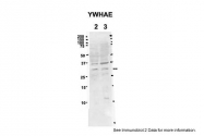 ARP32088_P050 - 14-3-3 protein epsilon