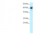 ARP32151_P050 - RNF12 / RLIM
