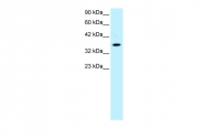 ARP32164_P050 - RAX / RX
