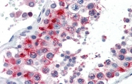 ARP32174_P050 - Homeobox protein goosecoid / GSC