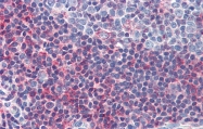 ARP32174_P050 - Homeobox protein goosecoid / GSC