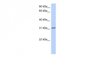 ARP32174_P050 - Homeobox protein goosecoid / GSC